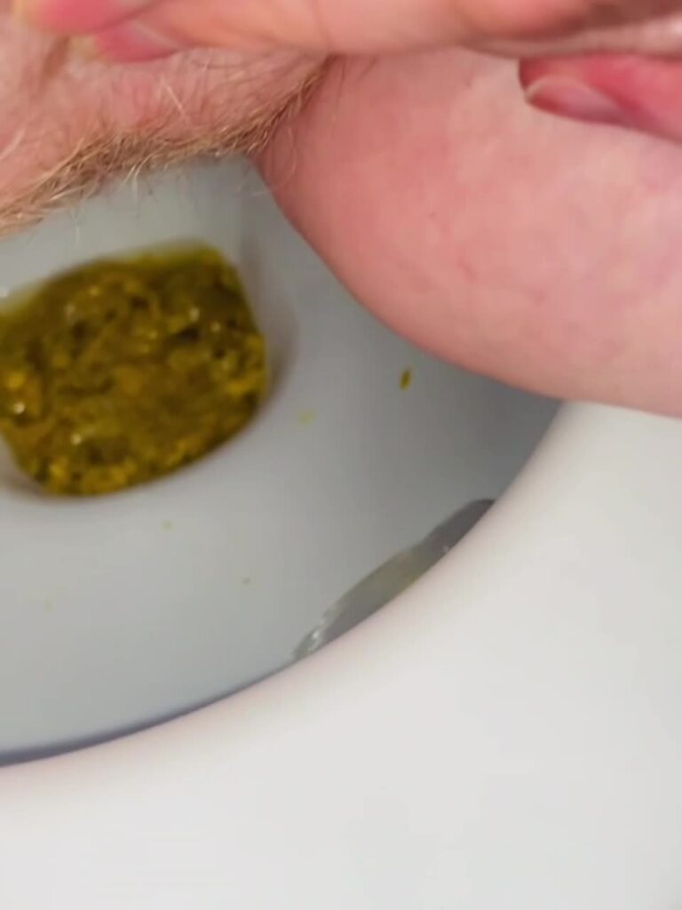 Diarrhea